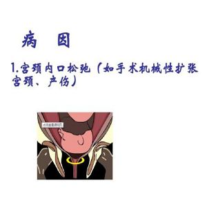 宫颈松弛