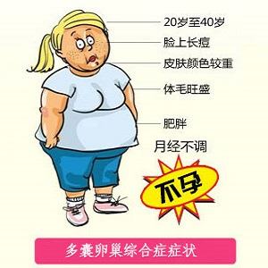 多囊卵巢综合症,PCOS