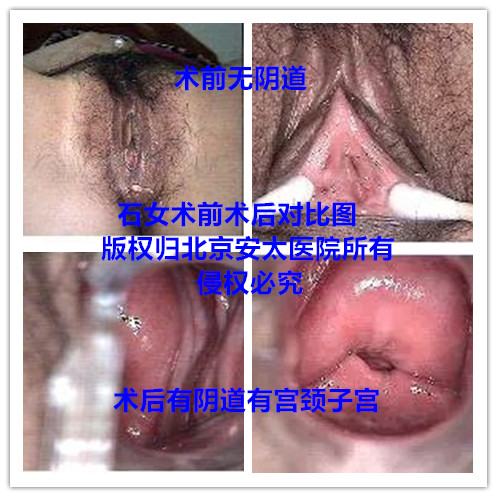 石女