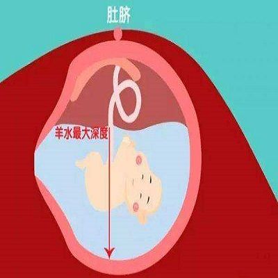 羊水多少