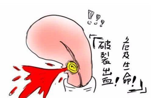 疤痕妊娠