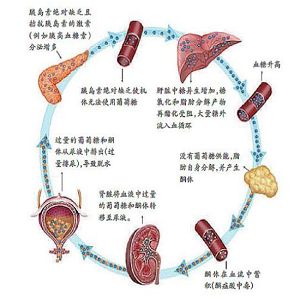 妊娠剧吐酸碱平衡紊乱