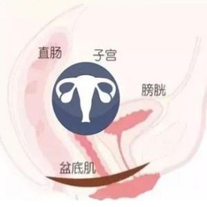 子宫切除