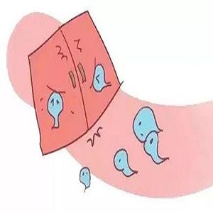 阴道横隔