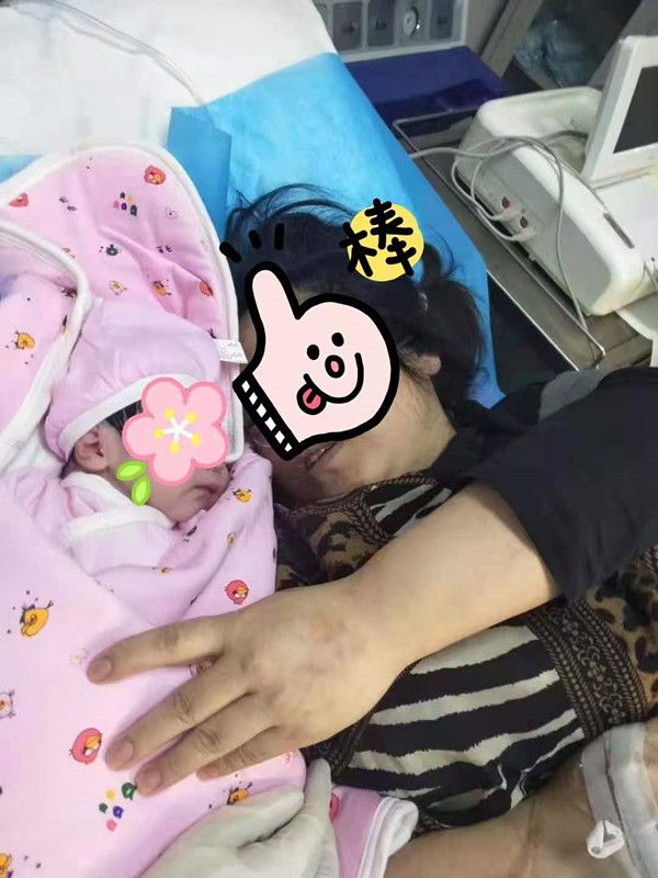 剖腹产后顺产