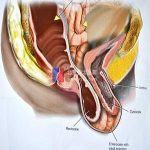 会阴裂伤阴道松 北京安太医院修复如初