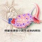 解说多囊卵巢