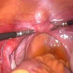 石女小李是如何走向幸福之路的?