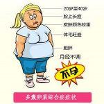 多囊卵巢综合症PCOS早期治疗的好处