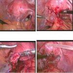 婚后不孕竟然是经期同房所致?