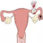 相约北京安太医院“宫外孕”日