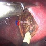 石女警惕过时的技术