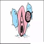 关于大阴唇整形