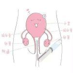 绿色消毒剂－臭氧