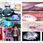 多囊卵巢综合征(PCOS)