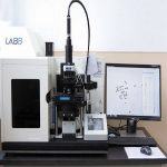 反复流产染色体检测有哪些?