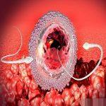 子宫内膜异位导致习惯性流产的原因