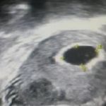 可视人流随做随走