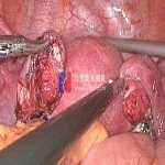 不孕的姜女士过不了婆婆的关