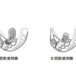 身为石女的她将工作视为一切