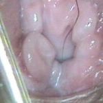 产后阴道松弛再也没有以前舒服的感觉