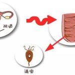 顽固性阴道炎表扬冒医生