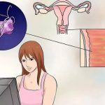 阴道炎霉菌，滴虫轮流得，是否还有特效药?