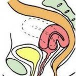 子宫脱垂的微创保宫治疗