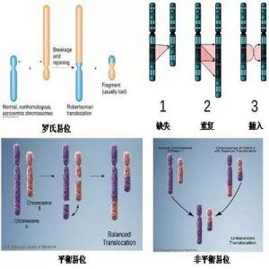 染色体异位