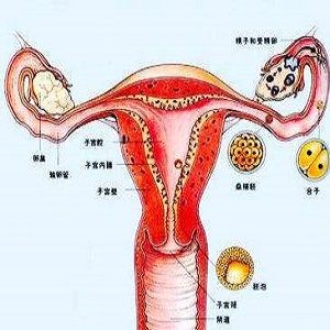 输卵管不孕