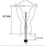 宫腔粘连病因之人为因素