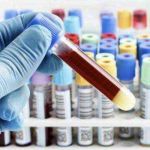 关于习惯性流产的检查与诊断有哪些？