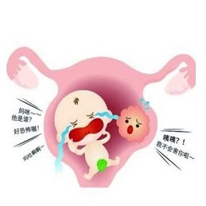 子宫肌瘤合并怀孕