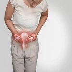 子宫内膜异位症状之痛经