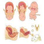 前庭大腺囊肿病因之损伤前庭大腺管