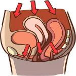 子宫脱垂病因之先天发育异常