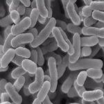 念珠菌性阴道炎检查