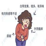 宫颈糜烂症状之阴道不规则出血