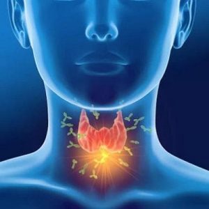 甲状腺功能亢进与复发性流产、习惯性流产