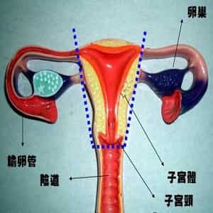 子宫切除