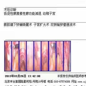 始基子宫,幼稚子宫