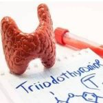 【视频】甲状腺功能低下(甲低)导致的复发性流产怎么办?