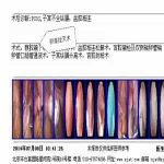 【成功】人流后不孕的她经人推荐来安太医院