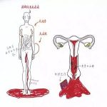 子宫内膜异位病灶可以生长在哪里?