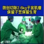 【视频】安太切除子宫肌瘤 27cm保留子宫