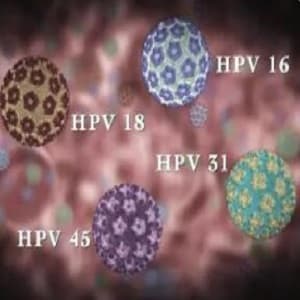 hpv感染