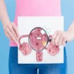 hpv患病率高不高?