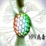 尖锐湿疣安太液治疗效果好