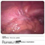 2年不孕治好了生三娃