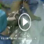 实录顺产“水中分娩”（视频）